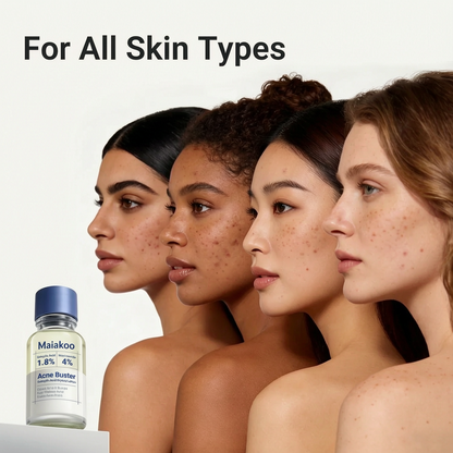 ✔️Maiakoo® Acne Drying Lotion Plus — Get Rid Of Acne Scars In 7 Days💯