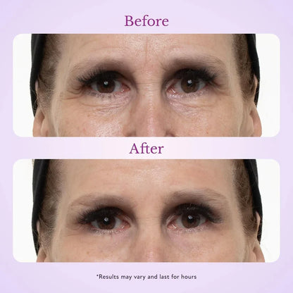 TopSpire 60 Second Effects Tinted Firming Gel - Under Eye Cream For Puffiness And Bags Under Eyes
