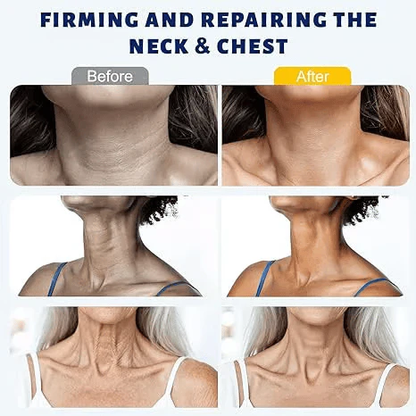 ✨Instant Neck Lift Cream — 🧴 Infused with Retinol & Hyaluronic Acid | Firms the Neck, Reduces Wrinkles
