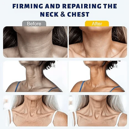 ✨Instant Neck Lift Cream — 🧴 Infused with Retinol & Hyaluronic Acid | Firms the Neck, Reduces Wrinkles