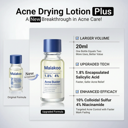 ✔️Maiakoo® Acne Drying Lotion Plus — Get Rid Of Acne Scars In 7 Days💯
