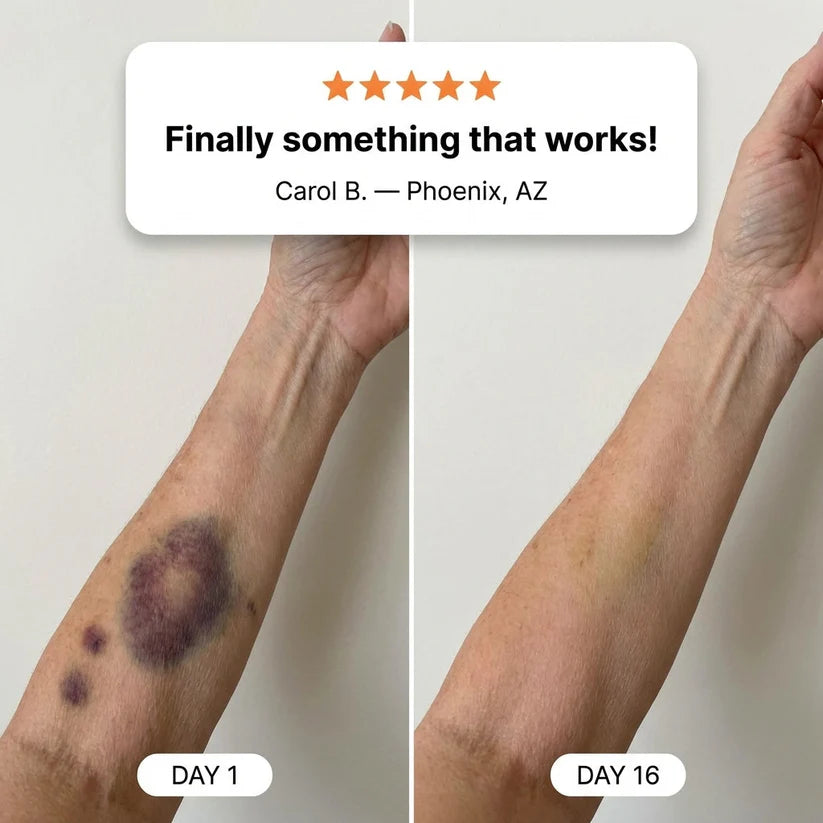 💥100K+ SOLD💕- MAIAKOO® Bruise Repair & Skin-Strengthening Cream