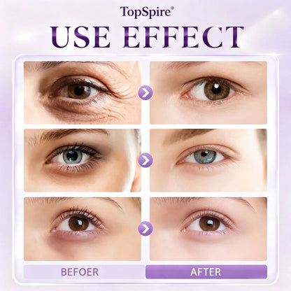 TopSpire 60 Second Effects Tinted Firming Gel - Under Eye Cream For Puffiness And Bags Under Eyes