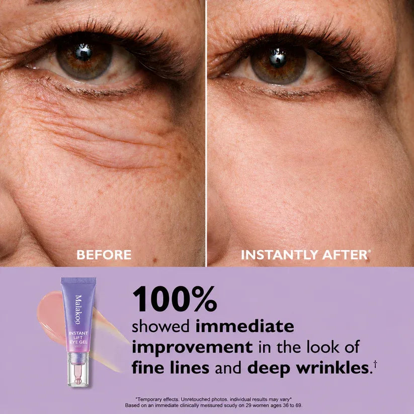 50 % RABATT · Zeitlich begrenztes Angebot ✨Maiakoo Instant Lift Augengel