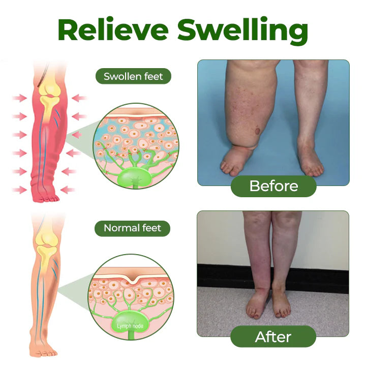 Maiakoo® Professional Leg Circulation Cream