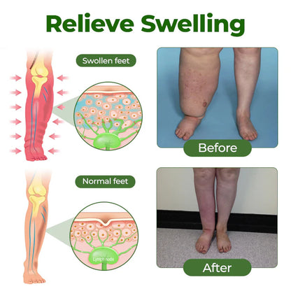 Maiakoo® Professional Leg Circulation Cream
