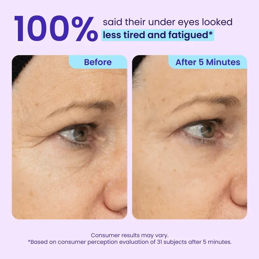 50 % RABATT · Zeitlich begrenztes Angebot ✨Maiakoo Instant Lift Augengel