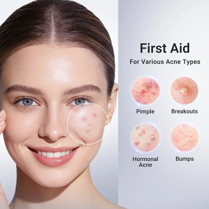 ✔️Maiakoo® Acne Drying Lotion Plus — Get Rid Of Acne Scars In 7 Days💯
