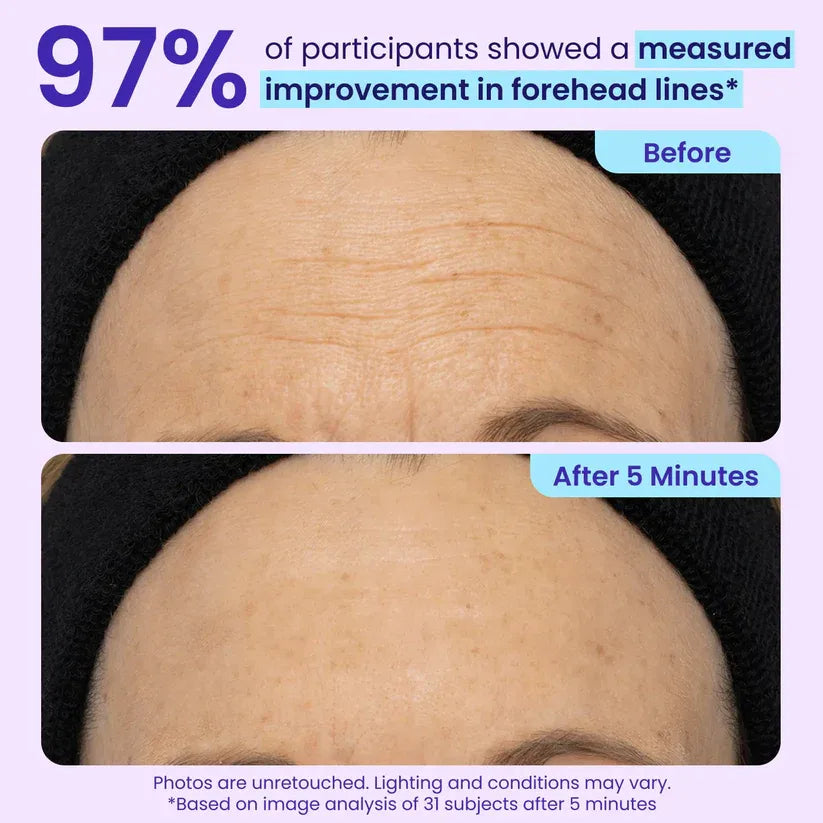 50 % RABATT · Zeitlich begrenztes Angebot ✨Maiakoo Instant Lift Augengel