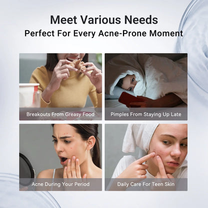 ✔️Maiakoo® Acne Drying Lotion Plus — Get Rid Of Acne Scars In 7 Days💯