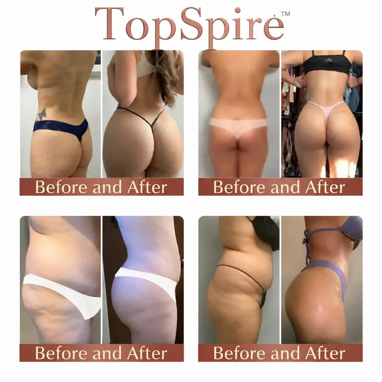 TopSpire™ CurveSculpt Micro-Patch ✦ Sculpt • Firm • Smooth Lower Body Curves ✦ Micro-Needle Infusion System